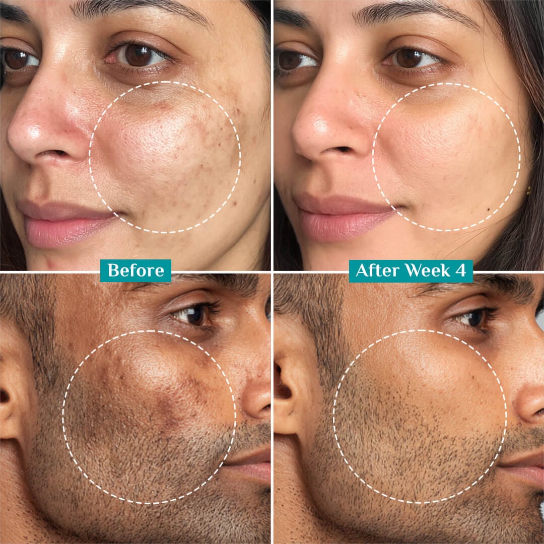 Pilgrim 15% Vitamin C Face Serum | with Ferulic Acid & Australian Kakadu Plum