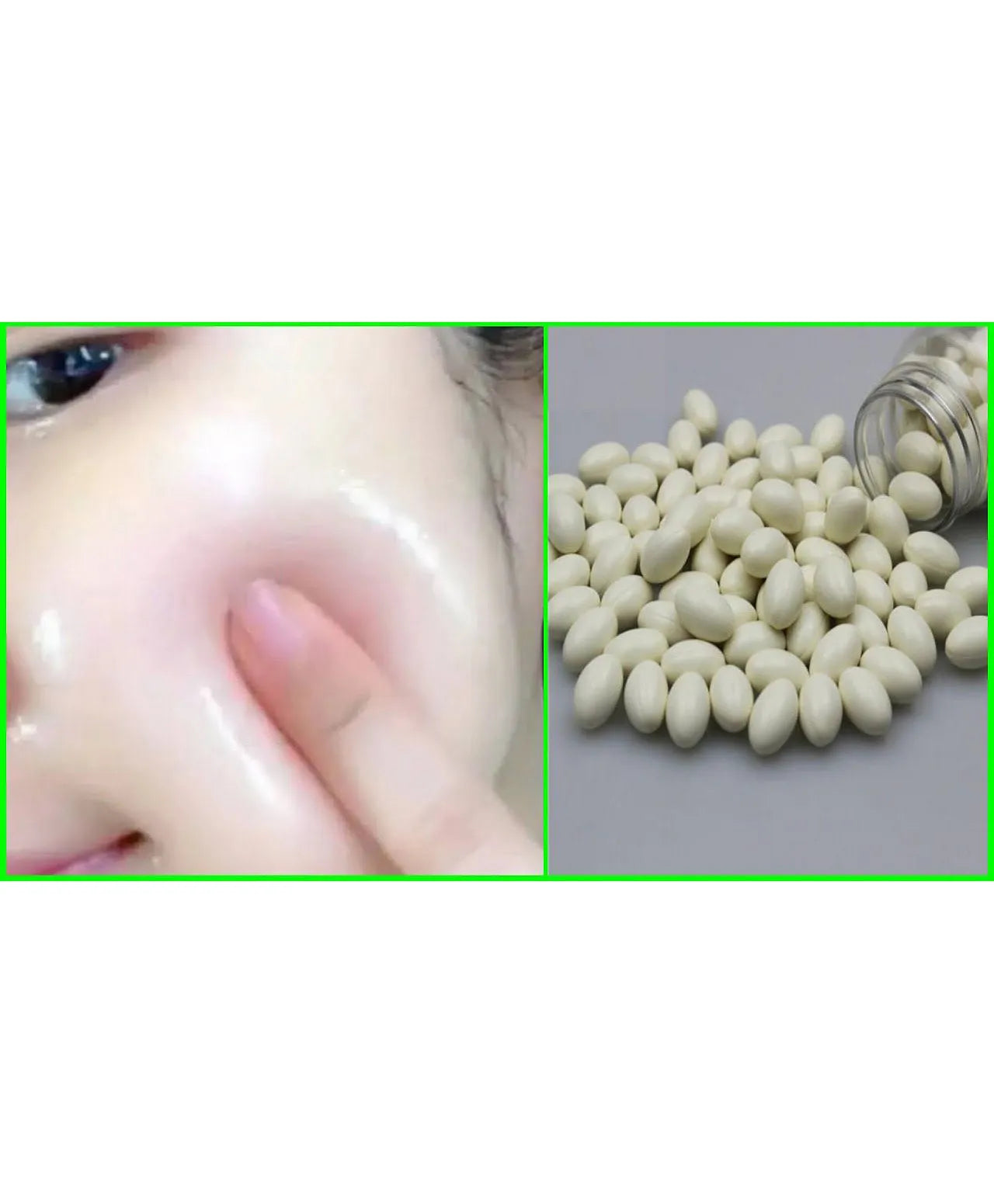 Professional Facial capsule Fore Skin Facial/ Brightening - 200 capsule