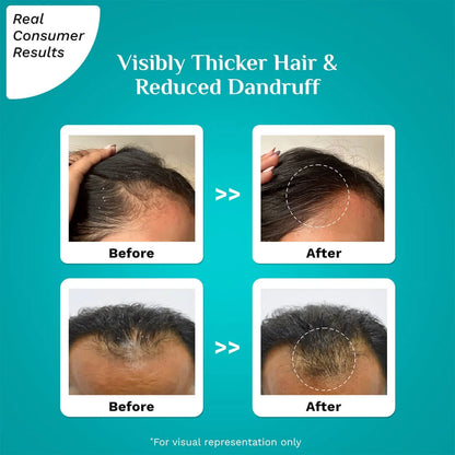 Pilgrim Advance Hair Growth Serum| 3%Redensyl & 4% Anagain with Korean Black Rice